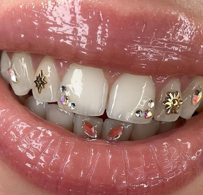 Your Custom Tooth Gem